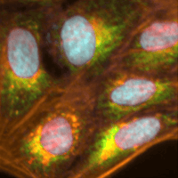 The OASIS Consortium: Can Multi-Omics Improve Chemical Safety Assessment? image
