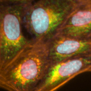The OASIS Consortium: Can Multi-Omics Improve Chemical Safety Assessment? image